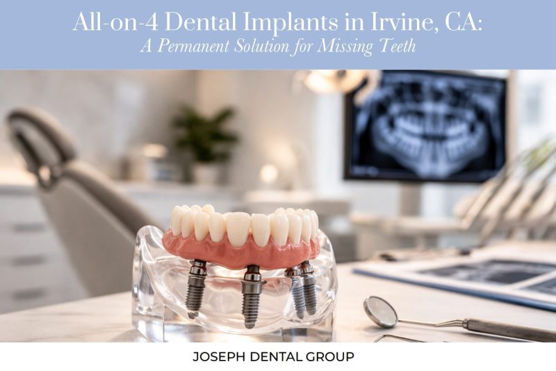 All-on-4 Dental Implants in Irvine, CA A Permanent Solution for Missing Teeth