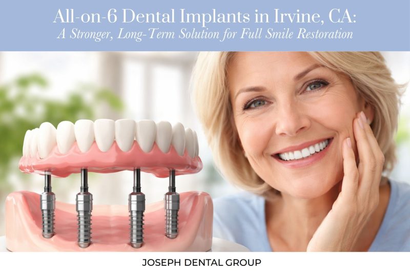 All-on-6 Dental Implants in Irvine, CA A Stronger, Long-Term Solution for Full Smile Restoration